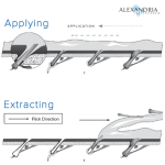 シュガーリングはなんでワックスより値段が高いの？
